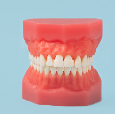 Can-you-get-veneers-for-dentures- Blog