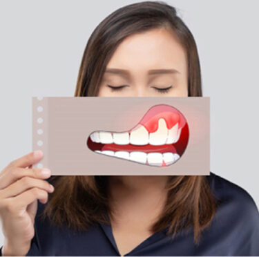 How can I rebuild my gums naturally