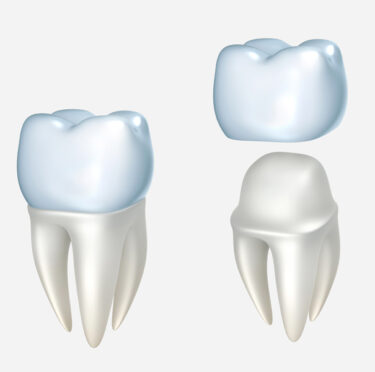 Can-anyone-get-dental-crowns - Blog